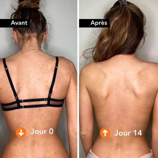 Nüo — Serviette Exfoliante